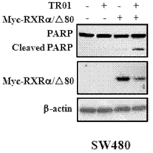 Application of triptolide, triptolide derivant and triptolide analogue in preparation of antitumor drugs