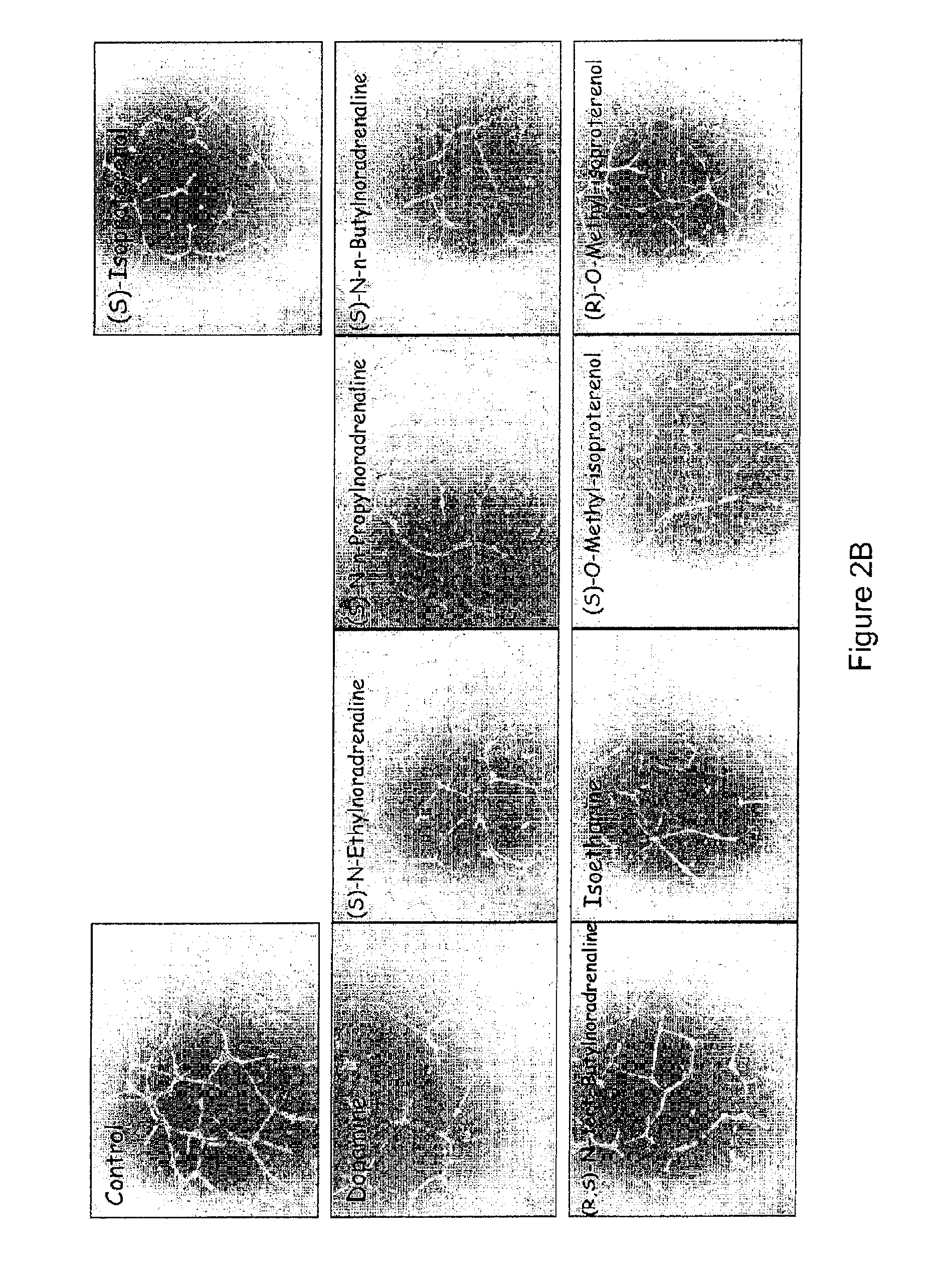 Use of catecholamines and related compounds as Anti-angiogenic agents