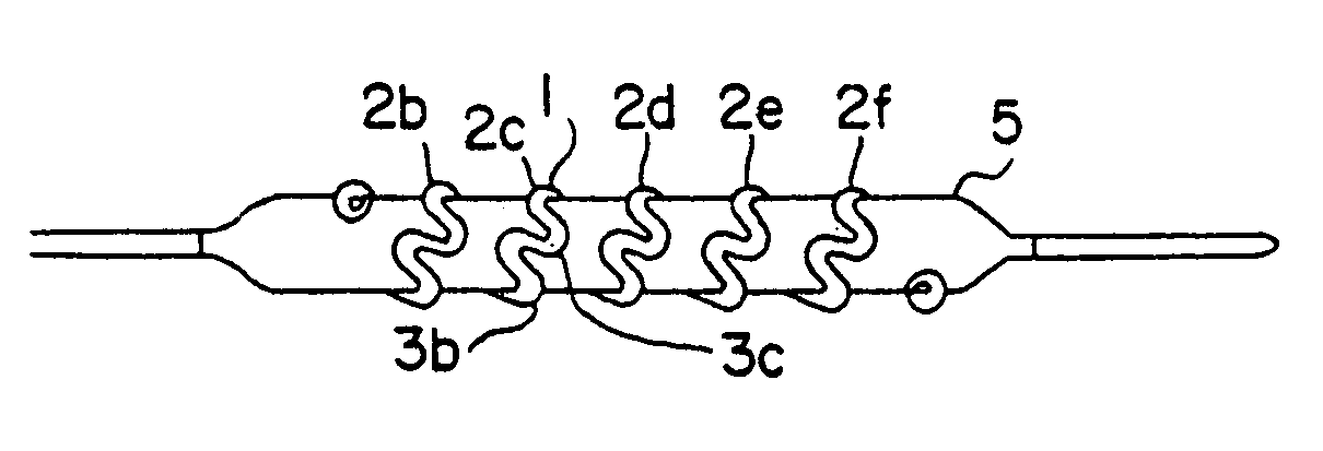 Intravascular stent