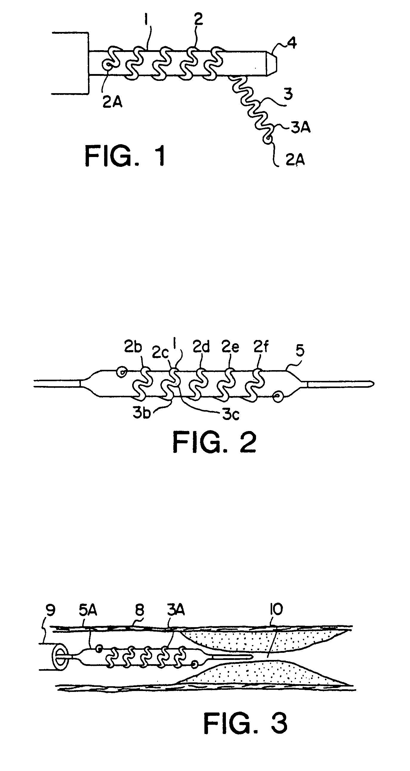 Intravascular stent