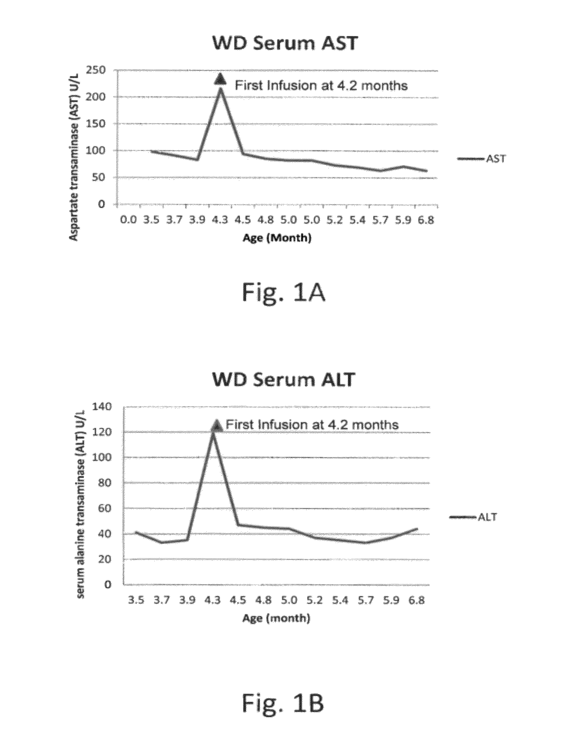 Methods for treating lysosomal acid lipase deficiency in patients