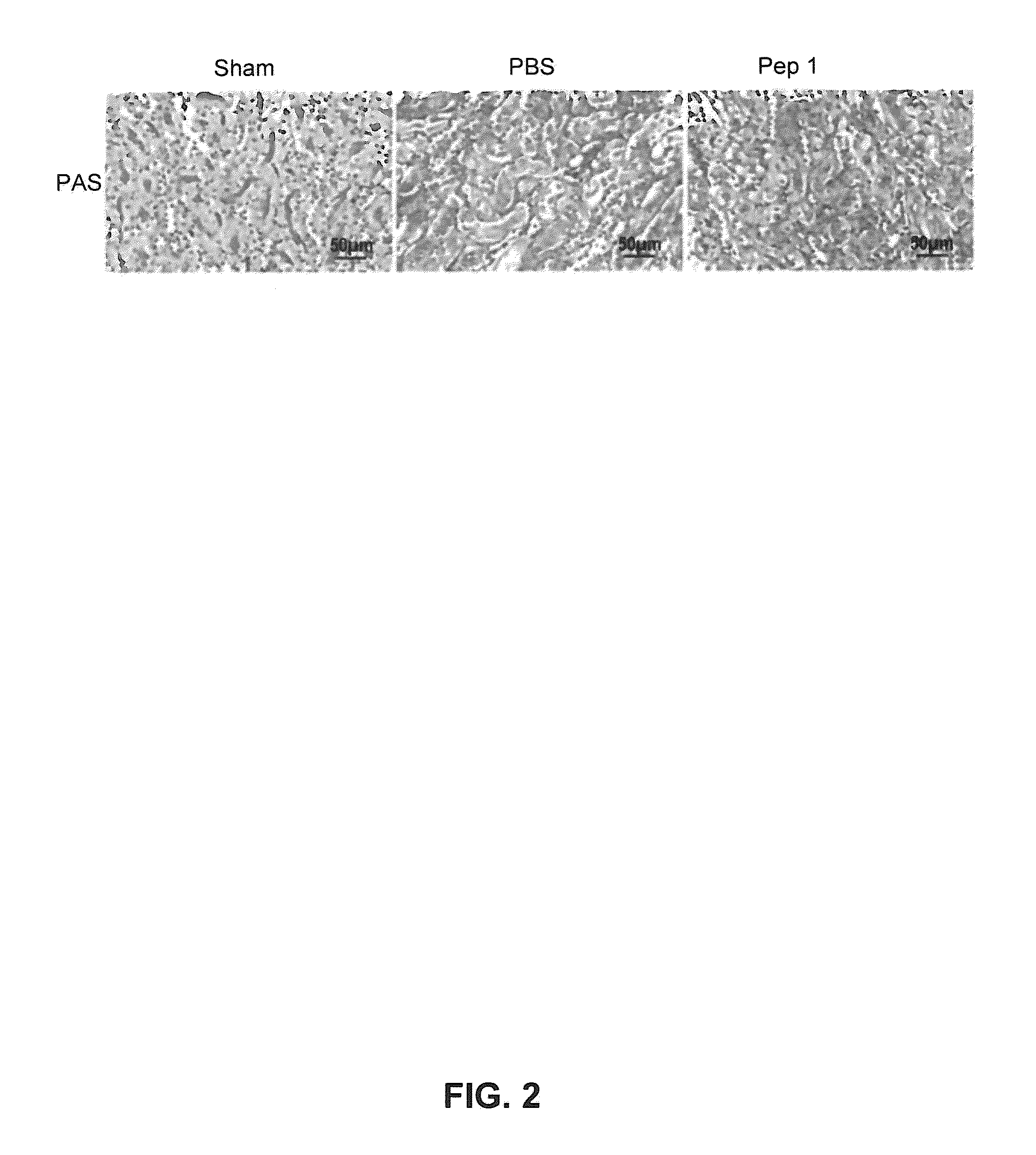 Composition for treating and preventing ischemic damage