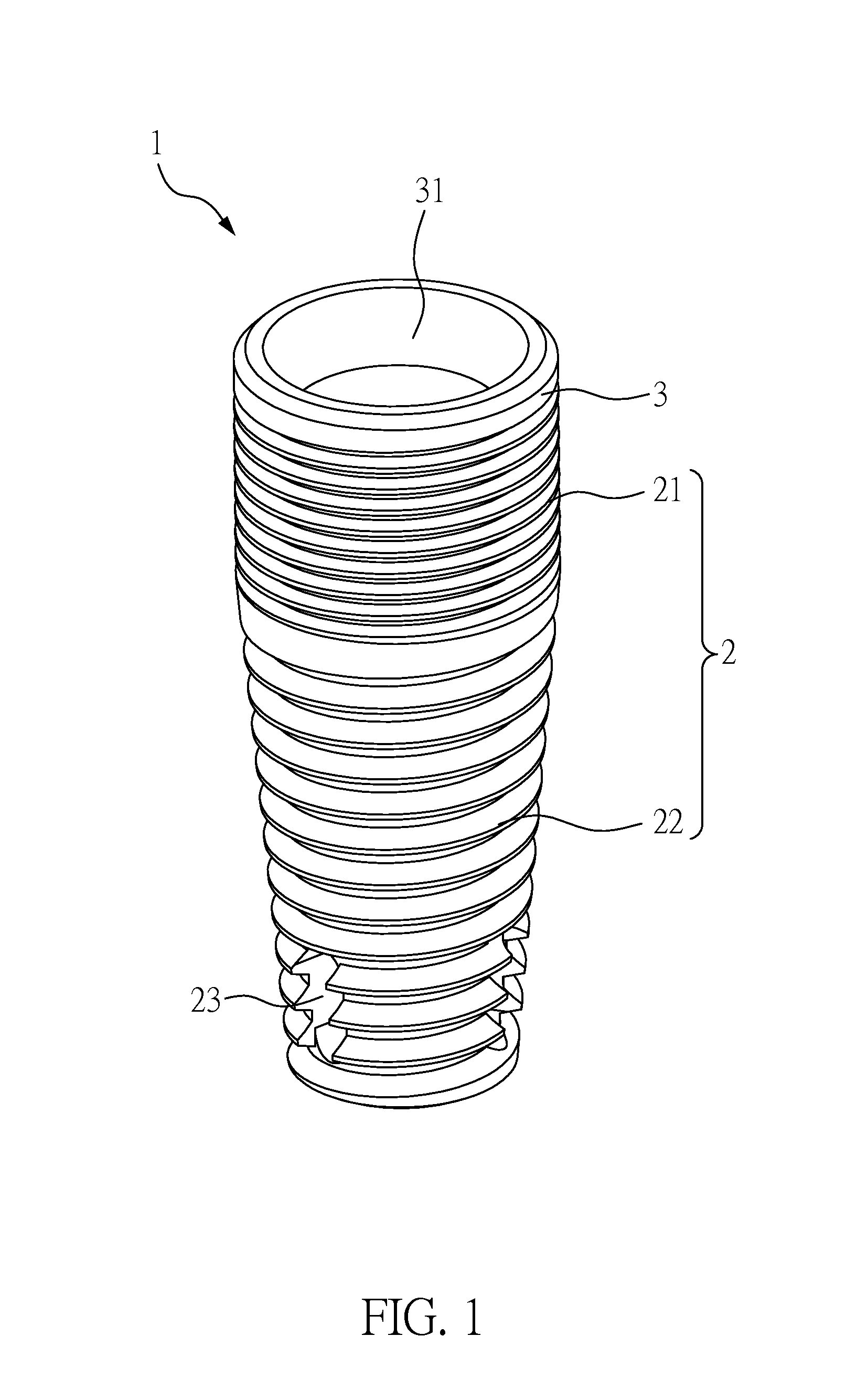 Tooth-Replacement Implant