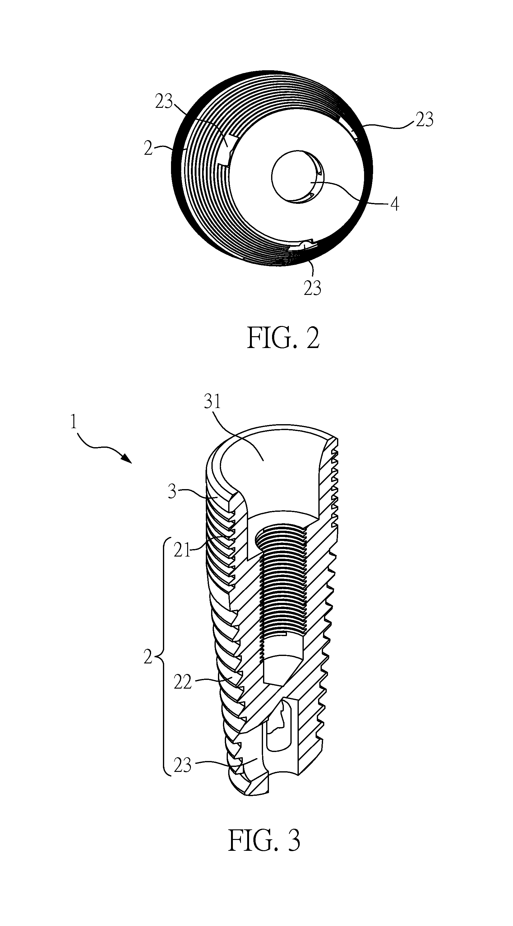 Tooth-Replacement Implant