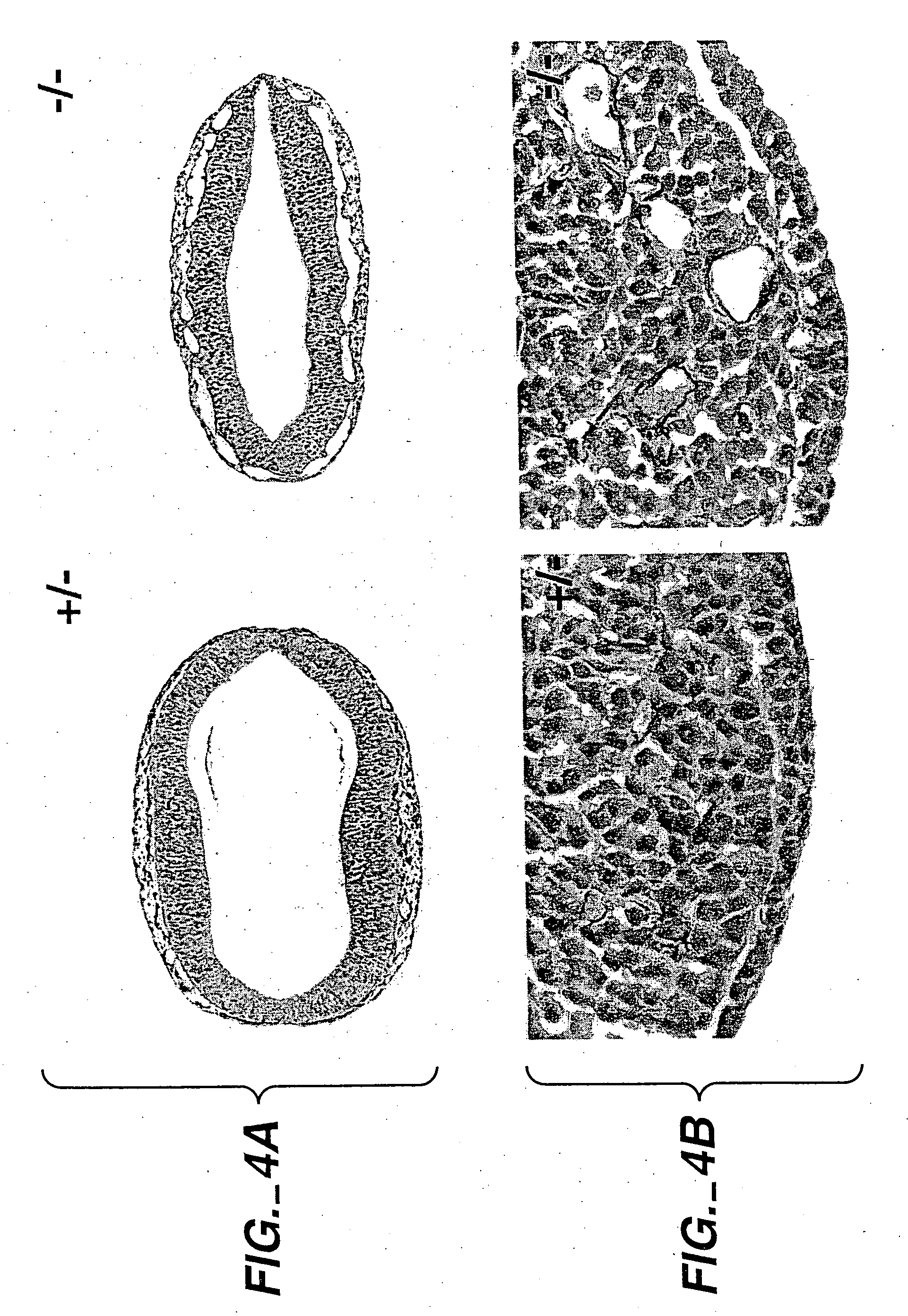 Methods for inhibiting angiogenesis by EphB receptor antagonists