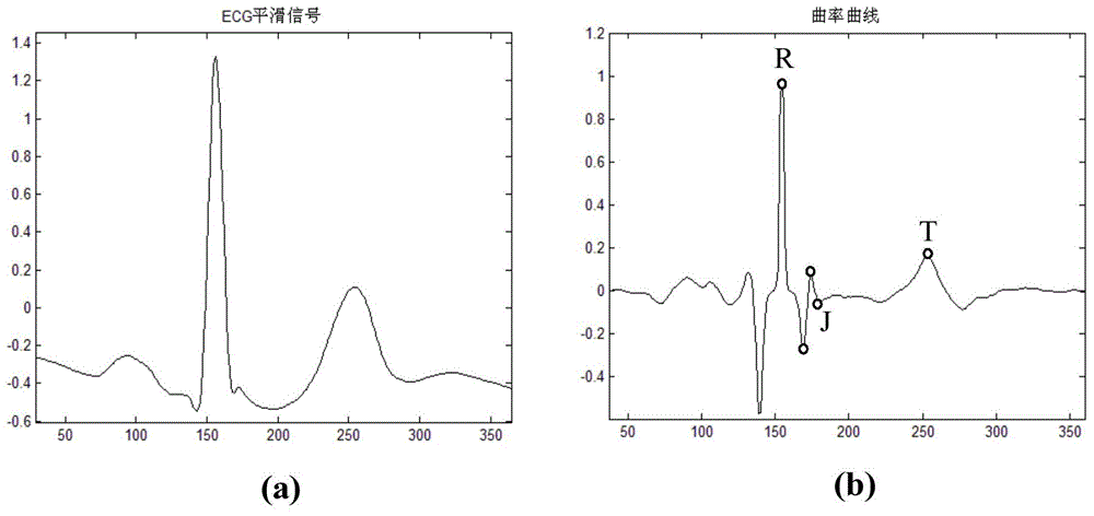 Automatic classification method for ST-segment evaluation patterns in electrocardiograph signals