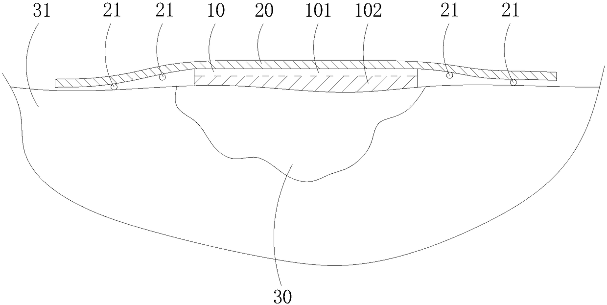 Anti-sticking dressing and manufacturing method thereof