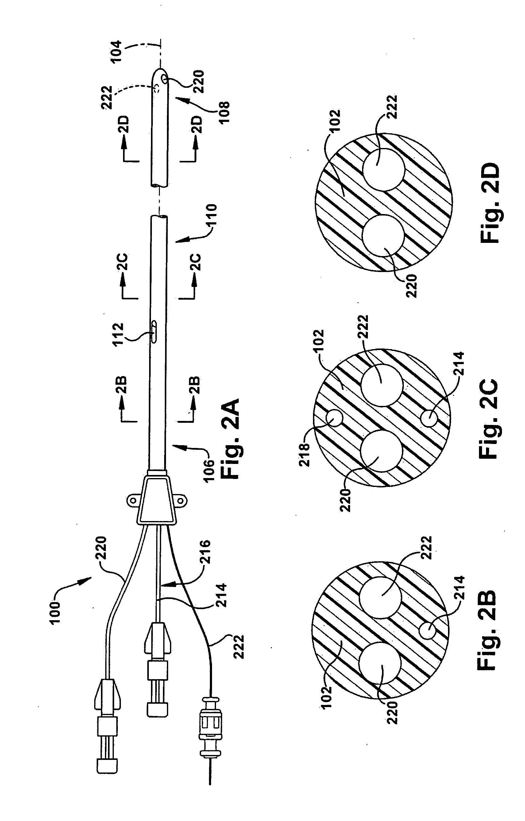 Intrajugular catheter