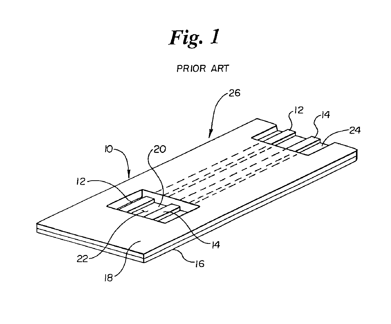 Biosensor electromagnetic noise cancellation