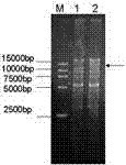 Recombinant HSV (Herpes Simplex Virus) amplicon vector and application thereof