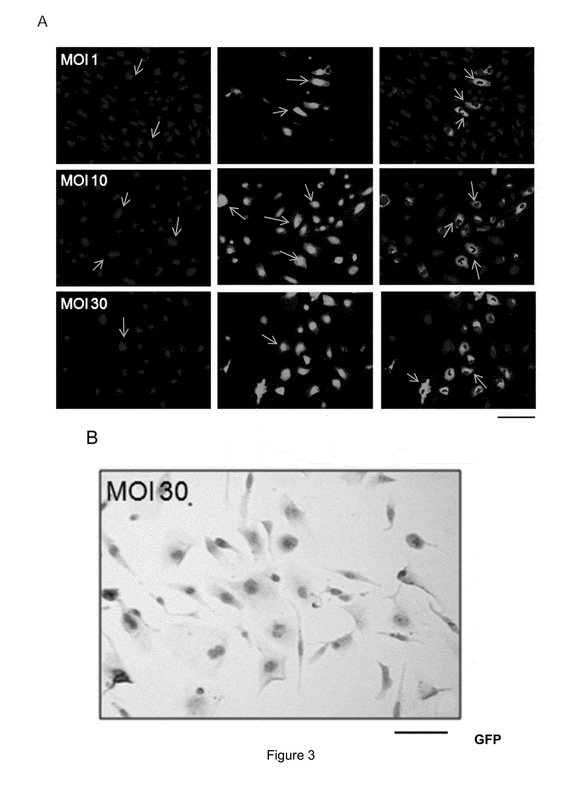 Myogenic differentiation of stem cells and and uses thereof