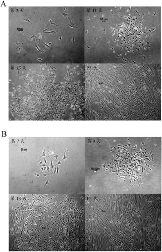 Fibroblast culture medium and application thereof