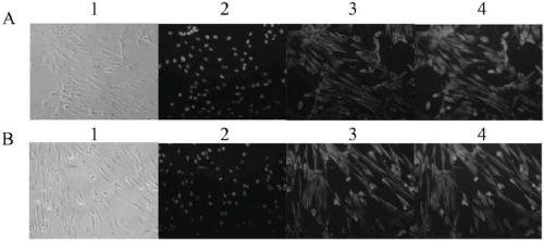 Fibroblast culture medium and application thereof