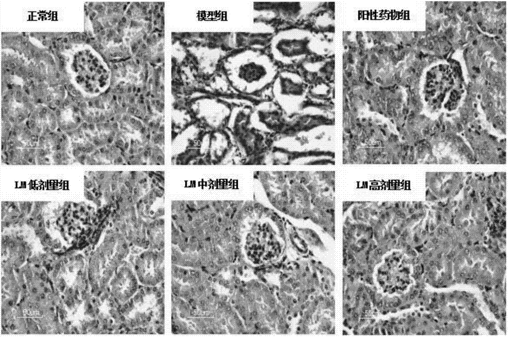 Purpose of lachnum melanin serving as blood fat-reducing medicament