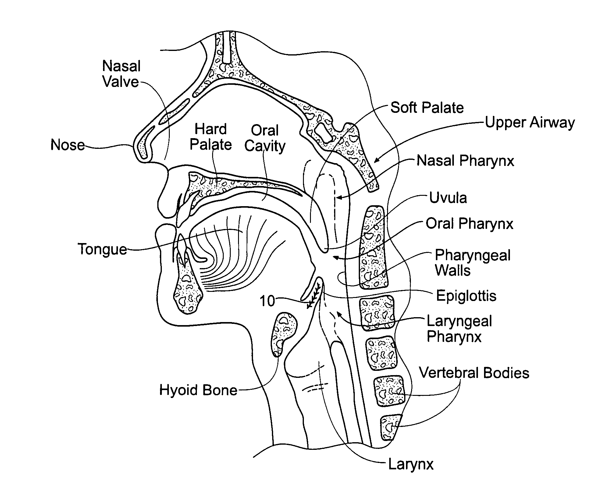 Implantable devices, systems, and methods for maintaining desired orientations in targeted tissue regions