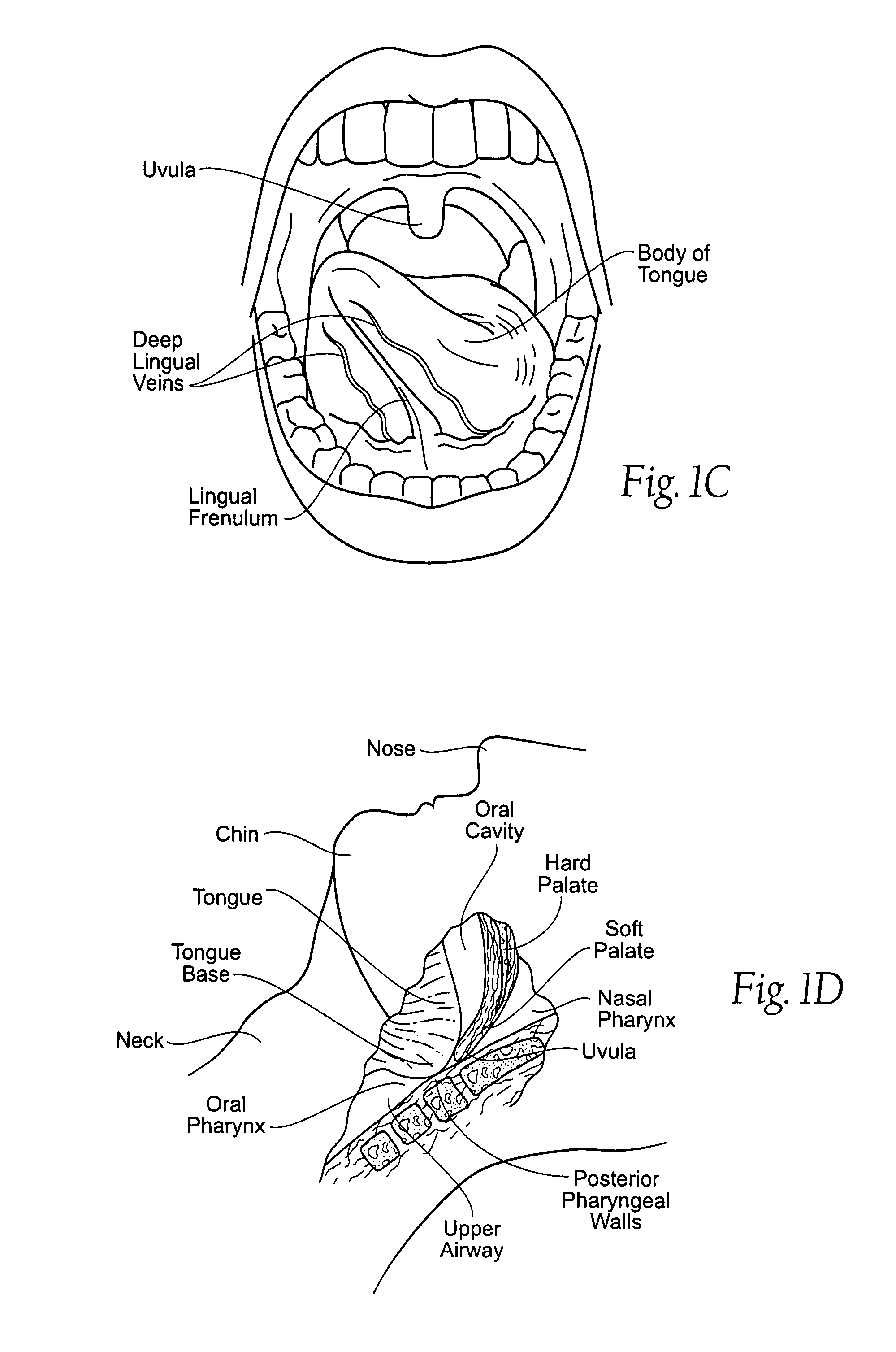 Implantable devices, systems, and methods for maintaining desired orientations in targeted tissue regions