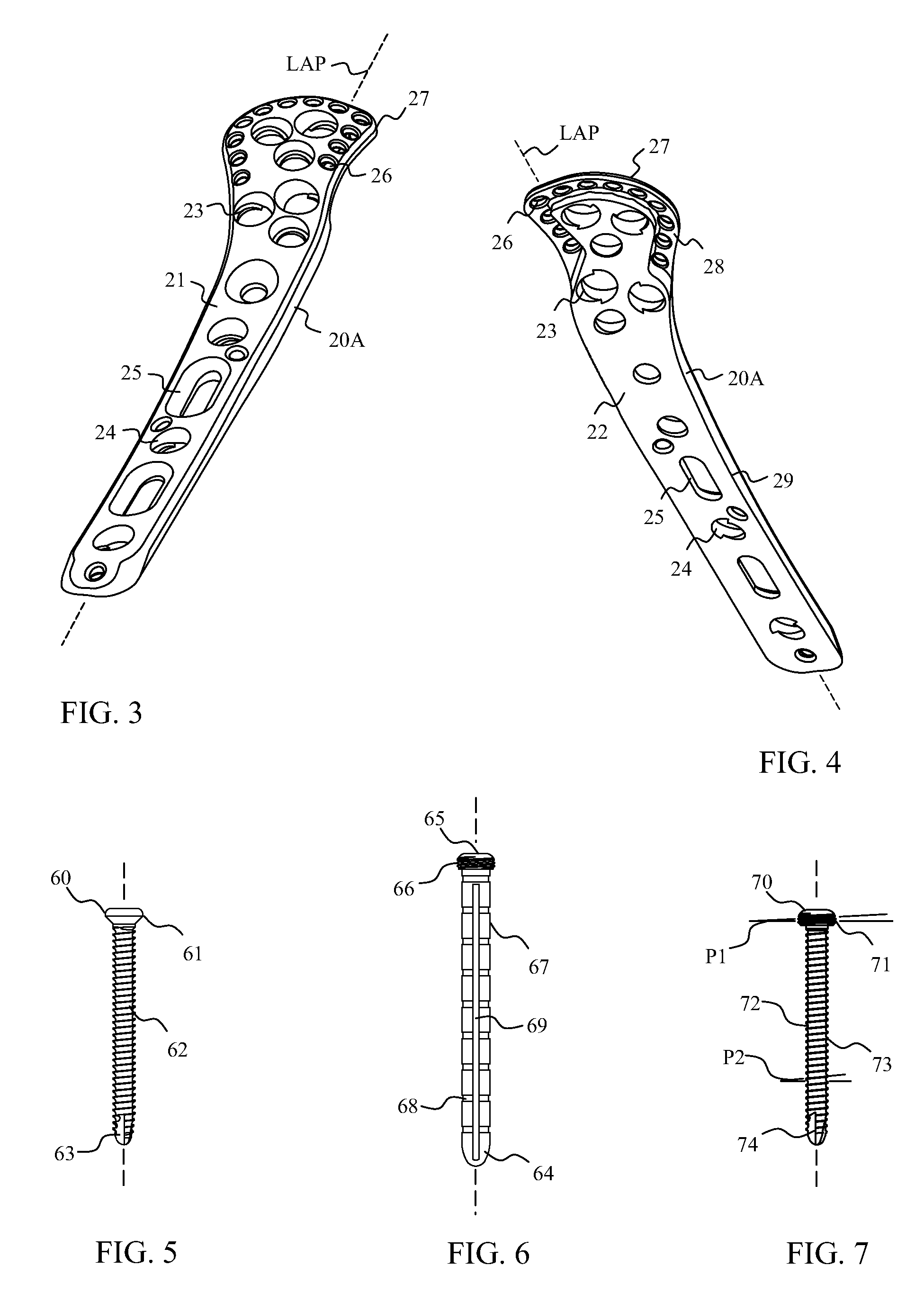 Proximal humerus fracture repair plate and system