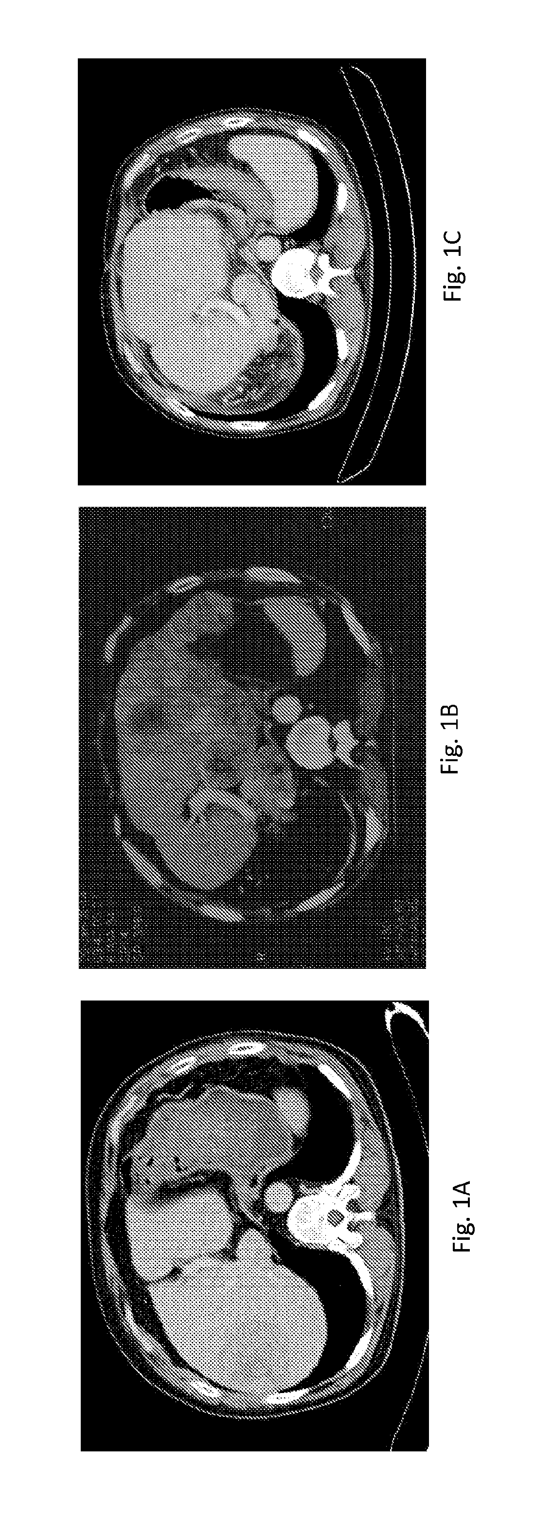 Oral composition and methods for immunotherapy