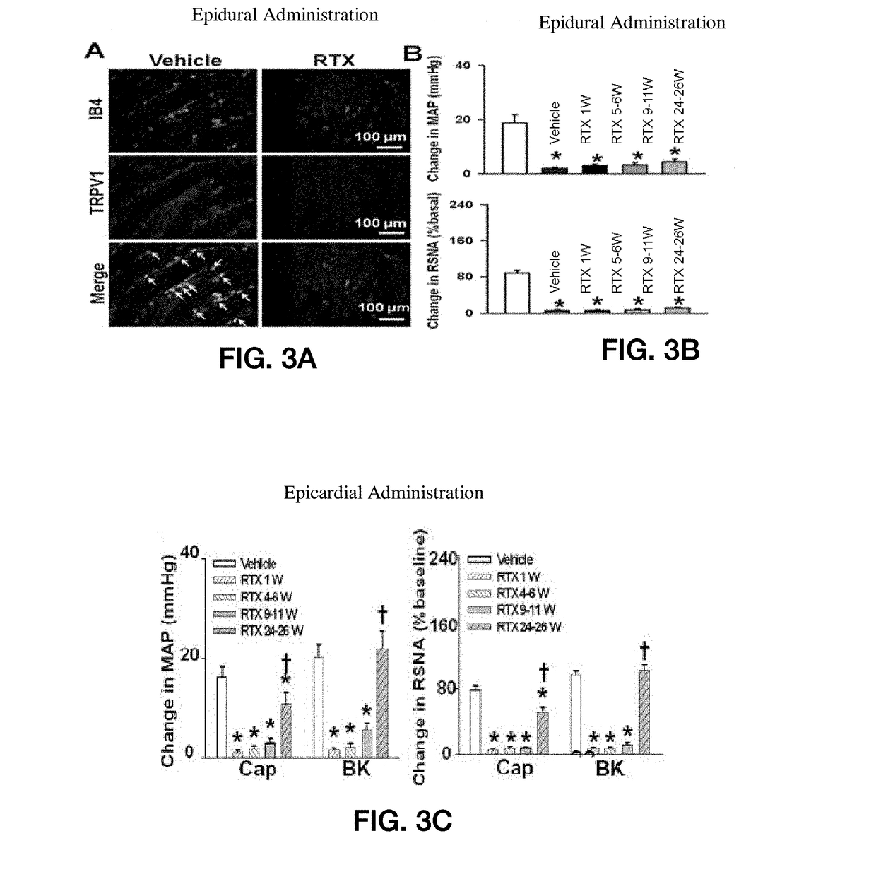 Methods for administration and methods for treating cardiovascular diseases with resiniferatoxin