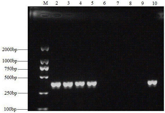 Molecular detection primer for banana cladosporium cucumerinum and detection method