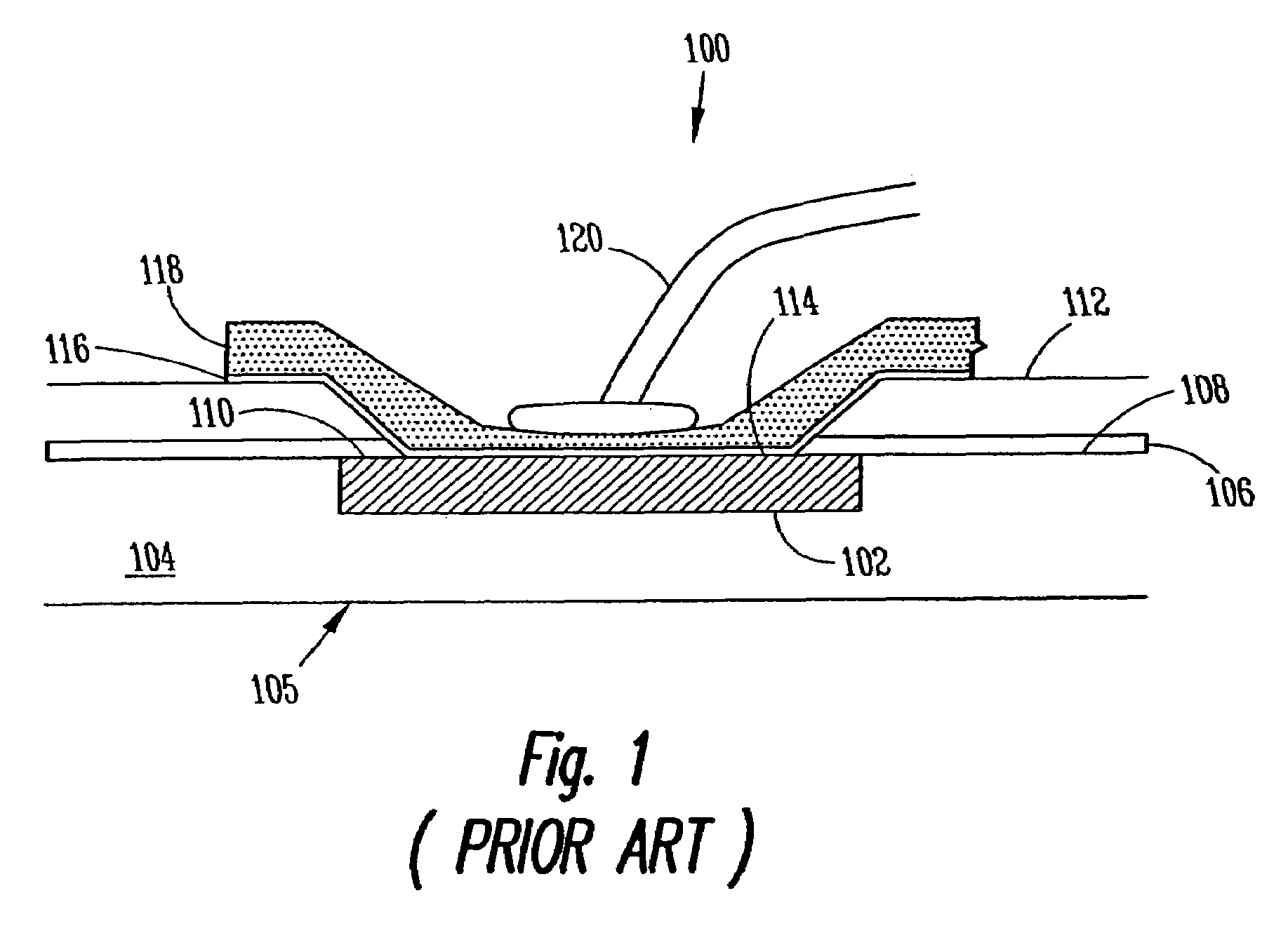 Wirebond structure and method to connect to a microelectronic die