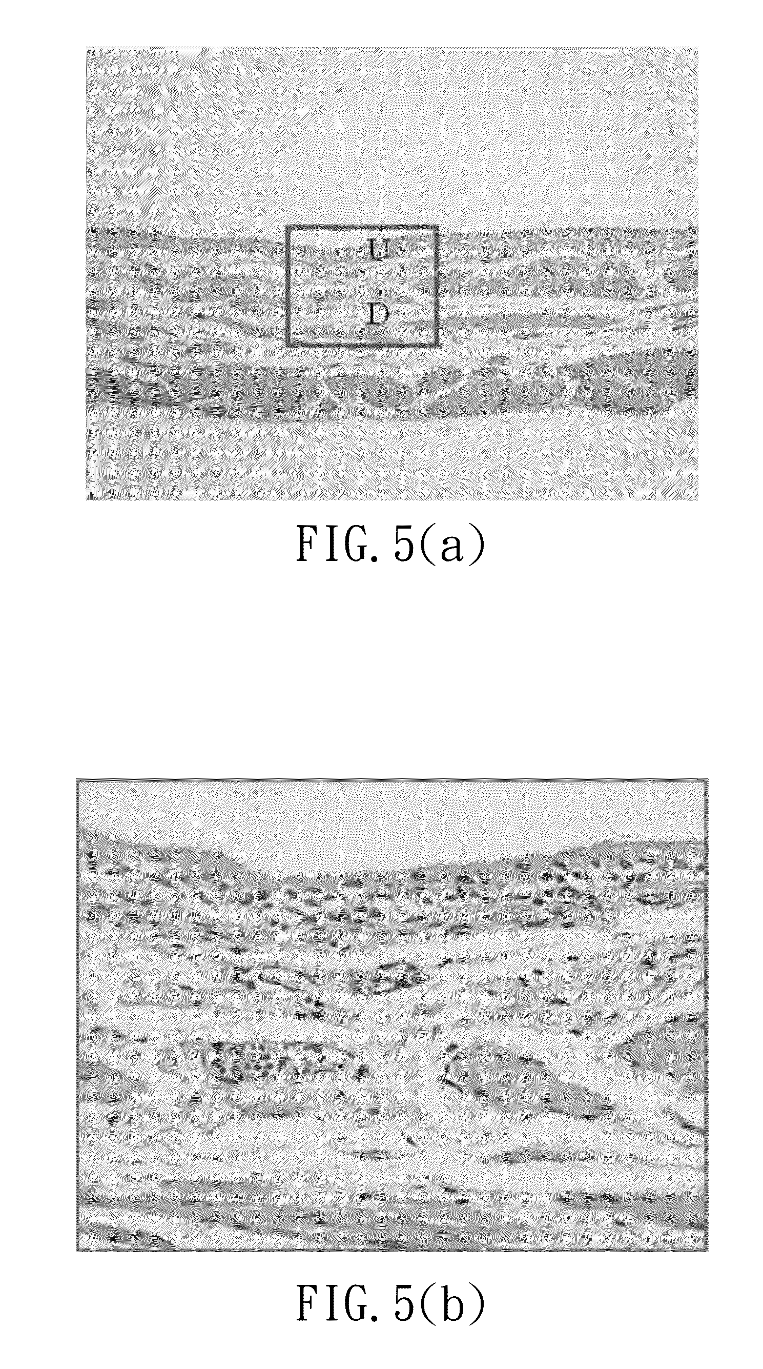 Method for treating urinary system disorders