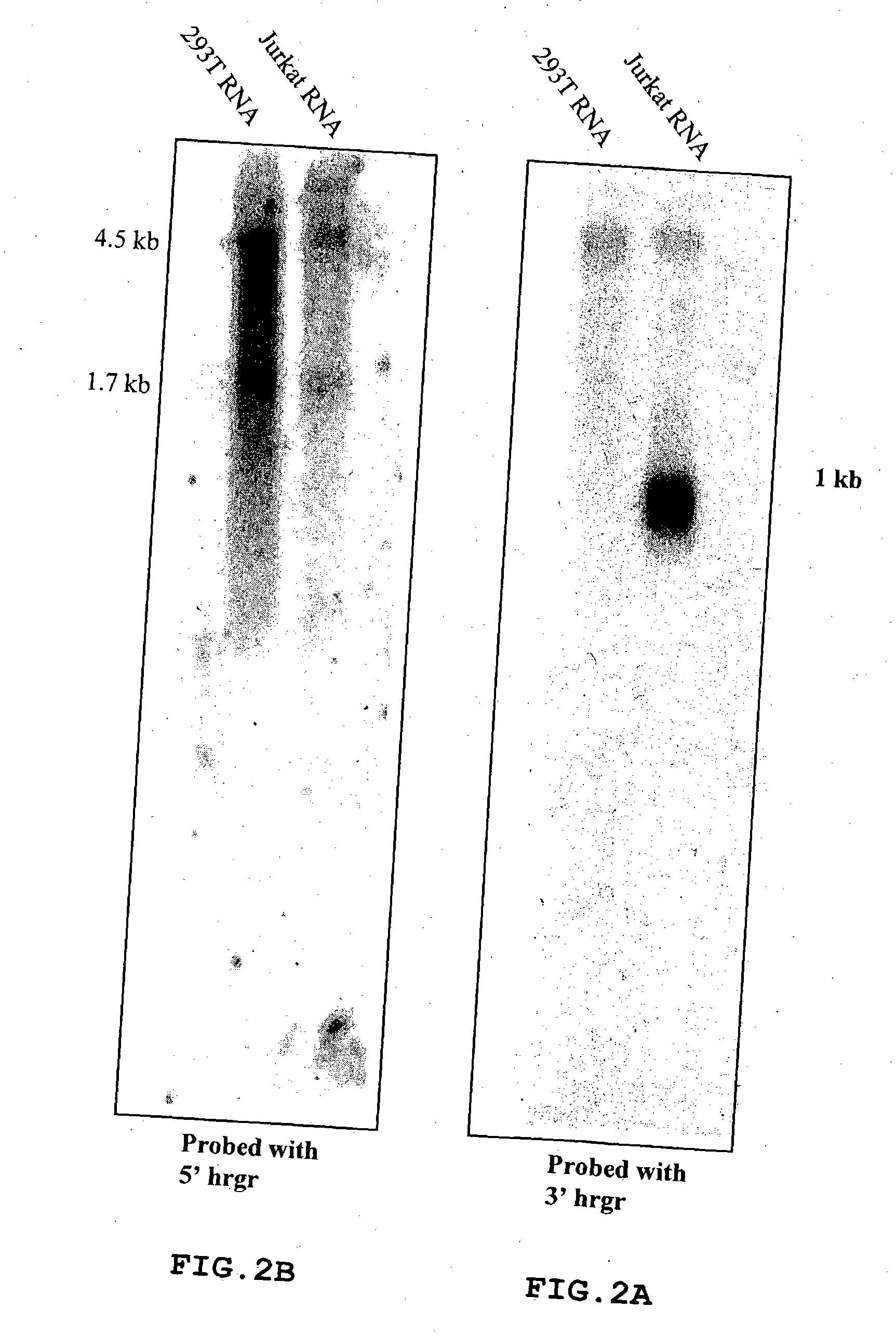 Human RGR oncogene and truncated transcripts thereof detected in T cell malignancies, antibodies to the encoded polypeptides and methods of use