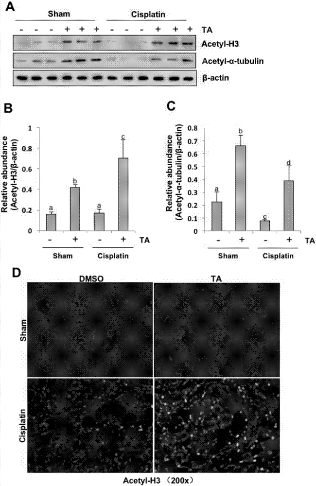 Application of inhibitor of histone deacetylase HDAC 6 in preparing drugs for preventing and treating acute kidney injury