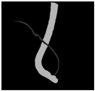 Bile duct stent specification selection method and device