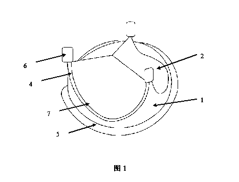 Heart bioprosthetic valve with valve leaflet capable of being repeatedly replaced through minimally invasive surgery