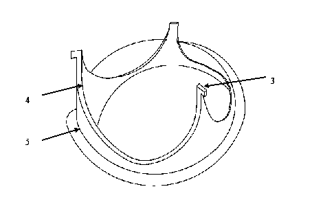 Heart bioprosthetic valve with valve leaflet capable of being repeatedly replaced through minimally invasive surgery