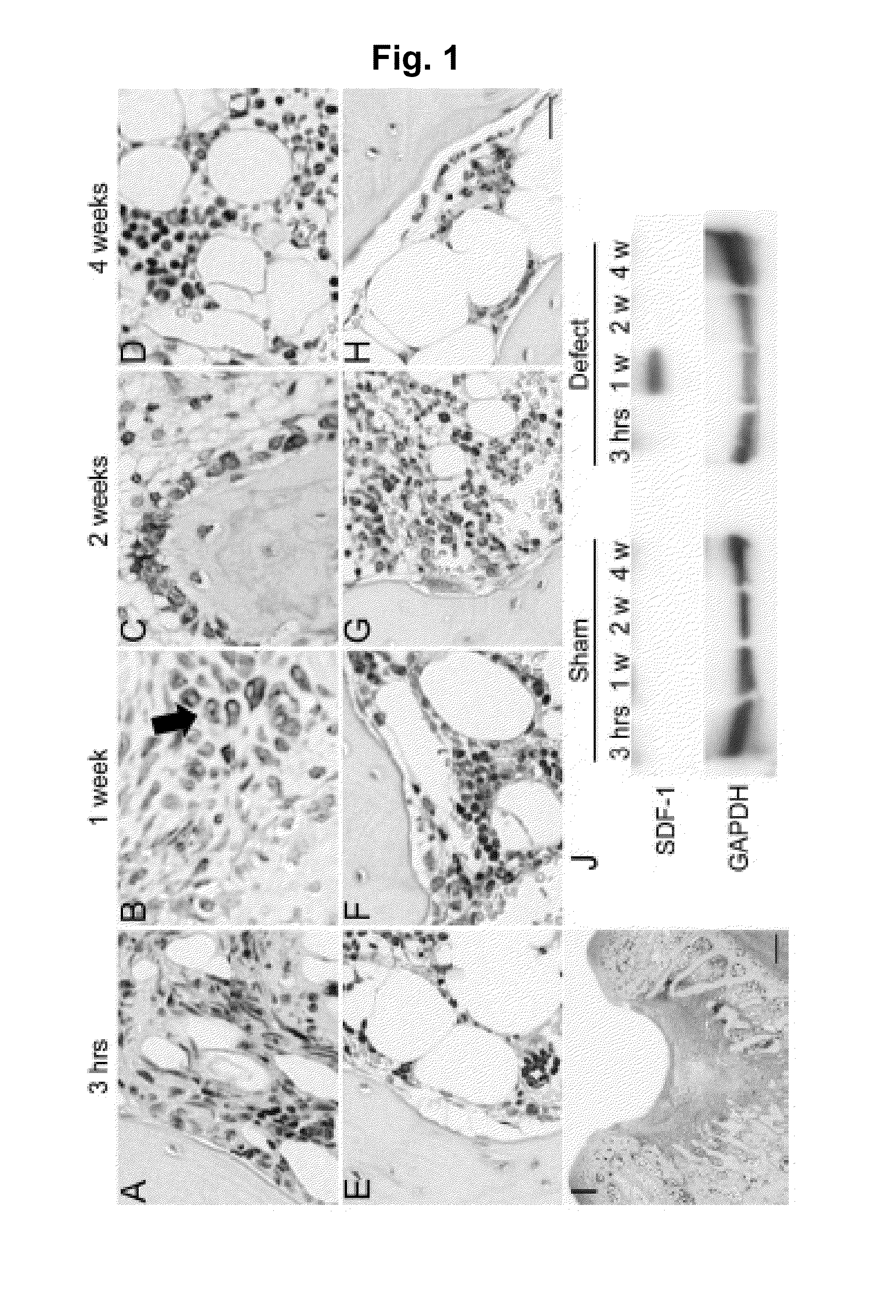 Composition for regeneration of cartilage