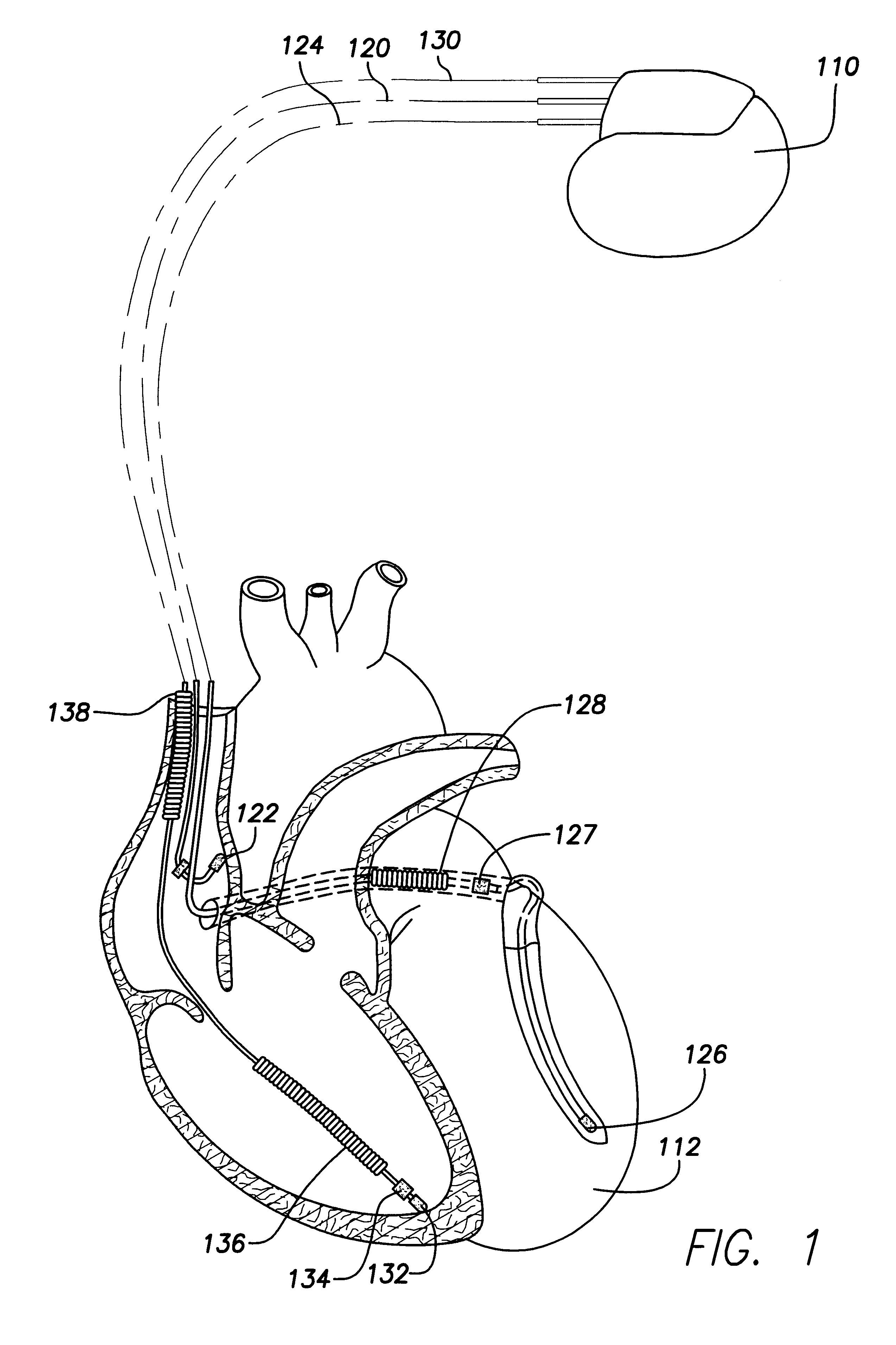 Evoked response variability as an indicator of autonomic tone and surrogate for patient condition