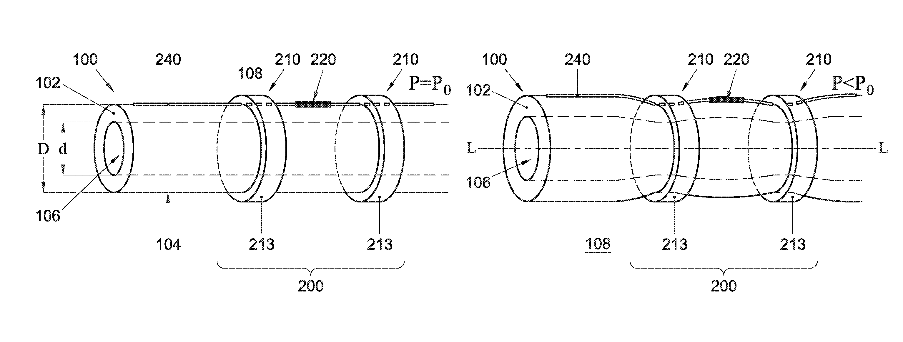 Pressure sensing assembly