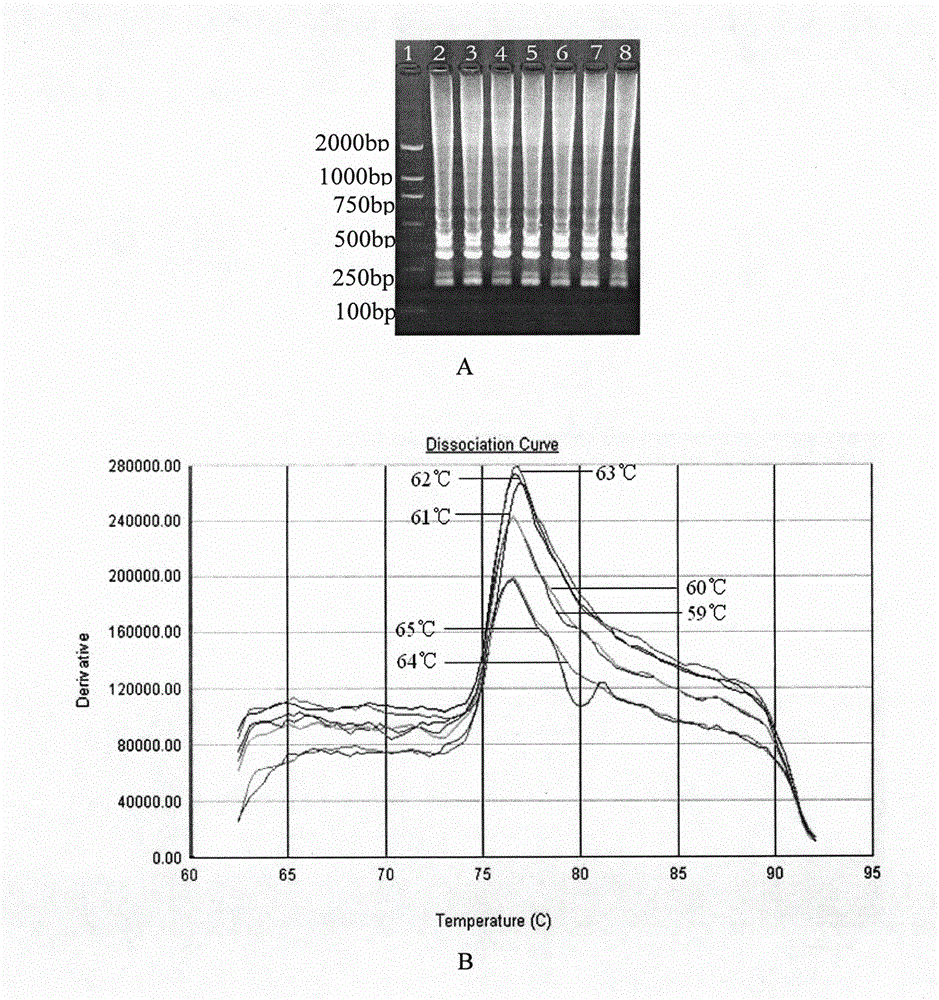 Method and kit for detecting reverse transcription-loop mediated isothermal amplification (RT-LAMP) of pike fry rhabdovirus (RFRV)