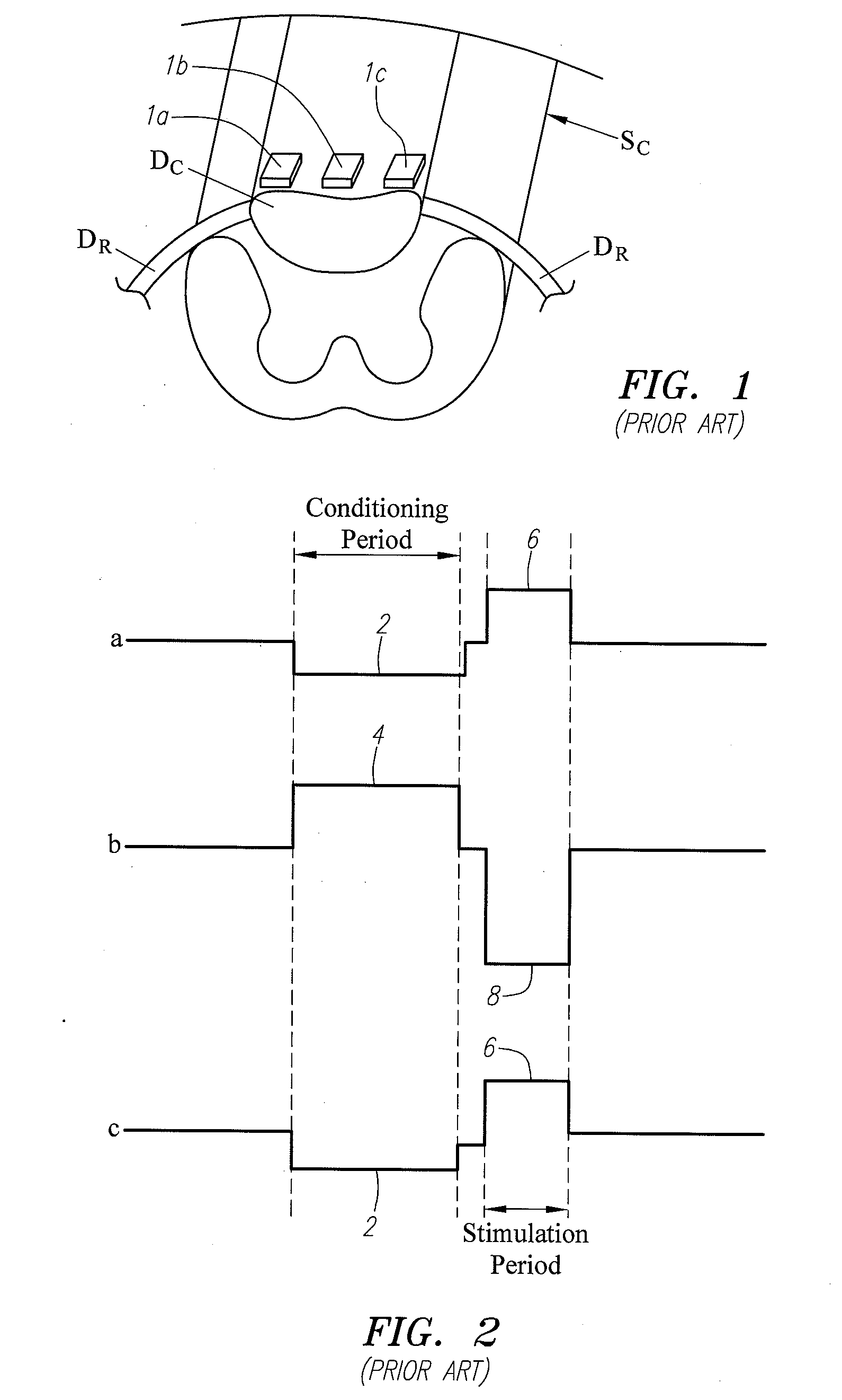 Coupled monopolar and multipolar pulsing for conditioning and stimulation