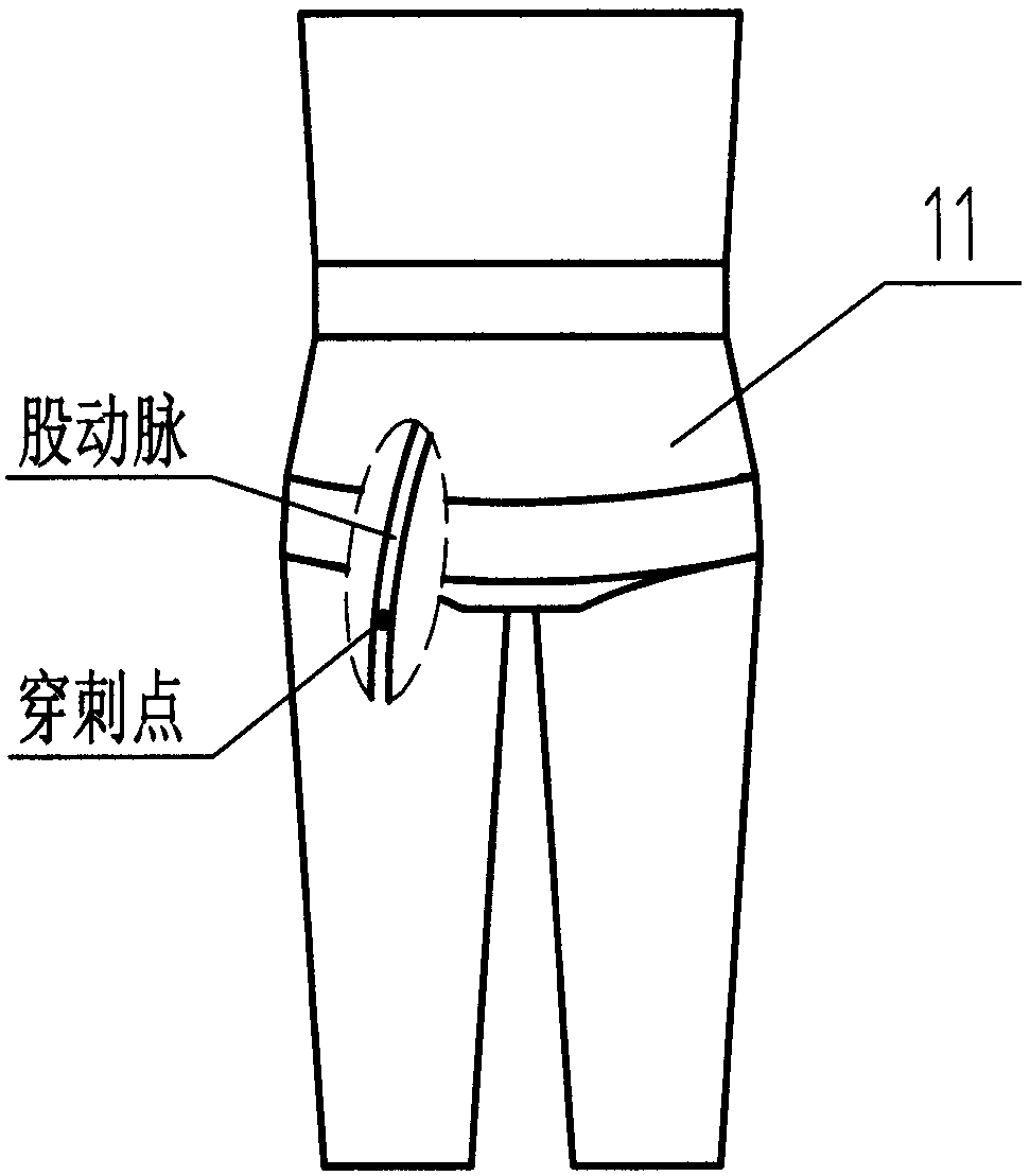 Auxiliary bandaging device for elastic bandage