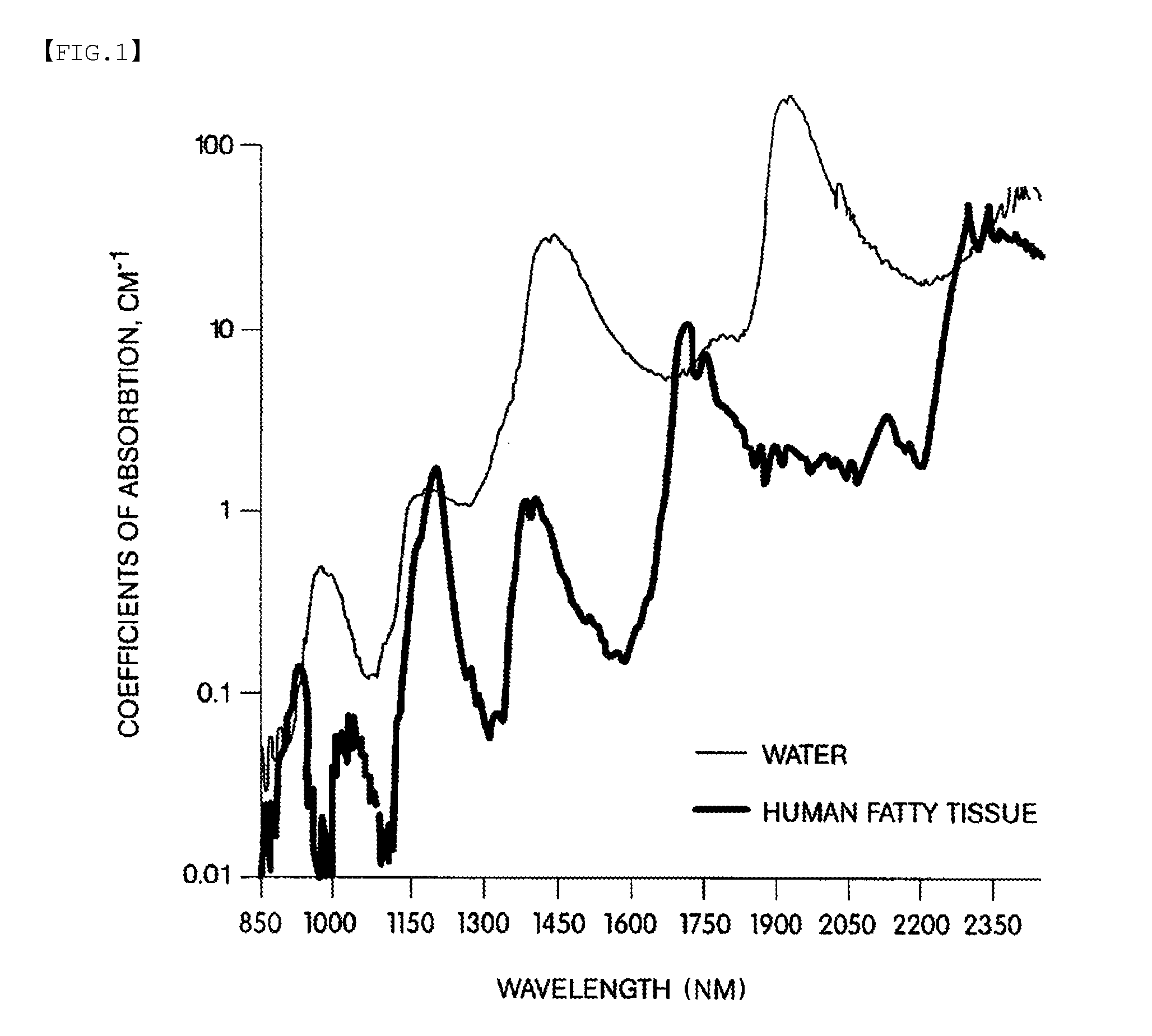 Method and apparatus for lipid removal using infrared opo laser