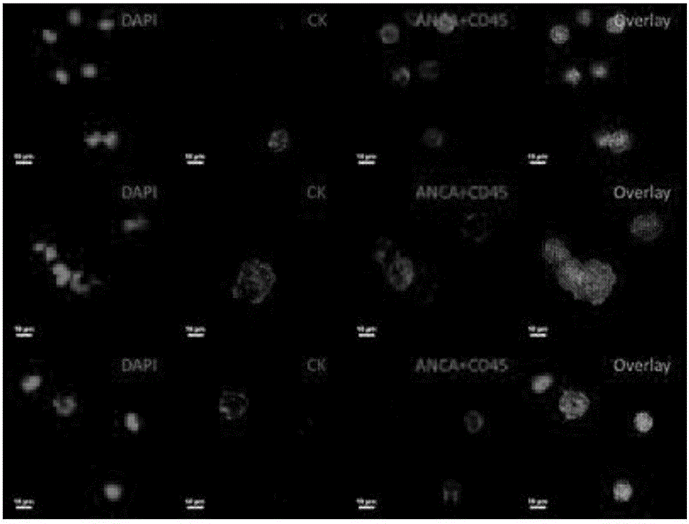 Probe and kit for circulating tumor cell and neutrophil leucocyte identification