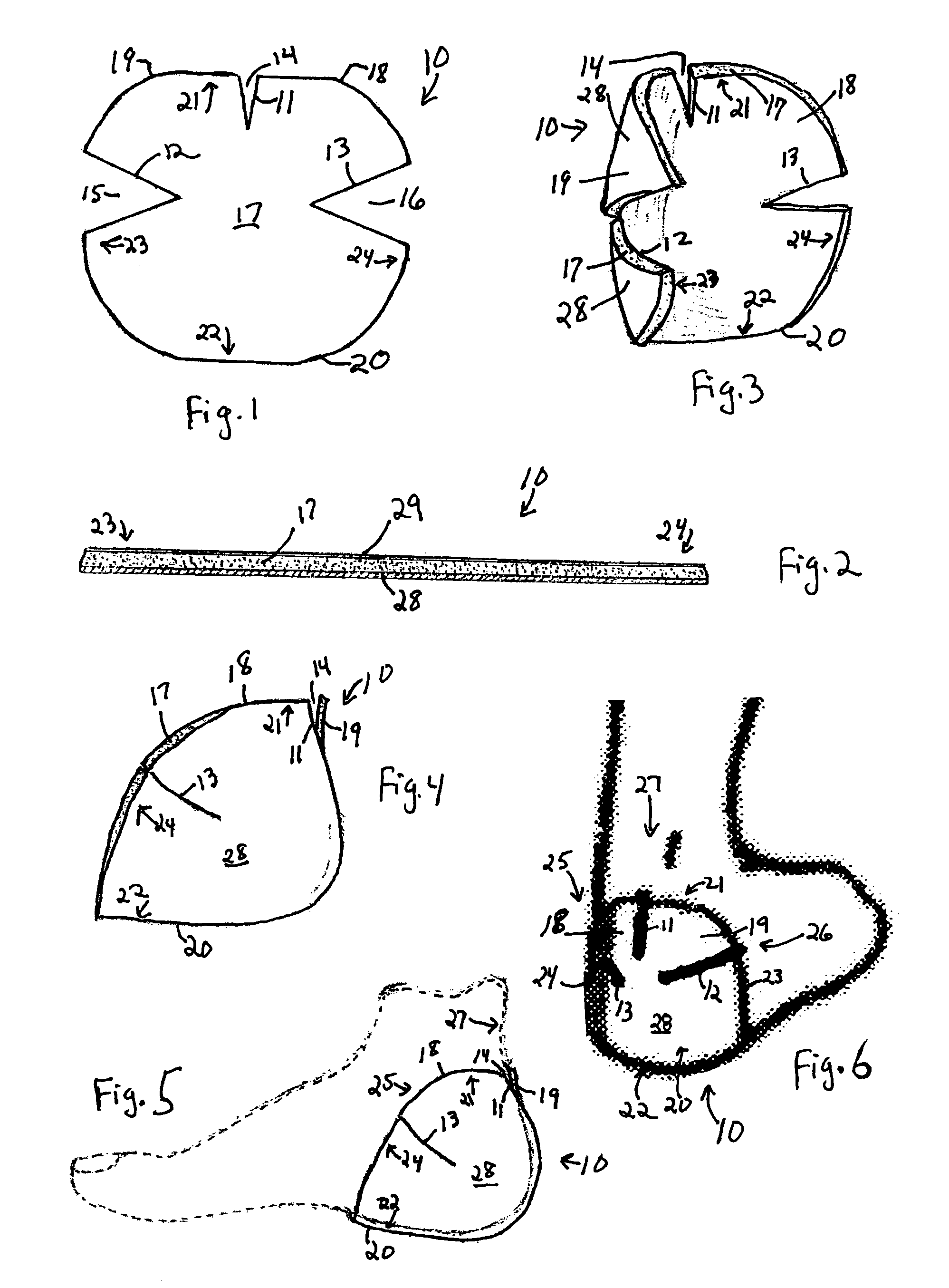 Tri-lobe planar heel wound dressing