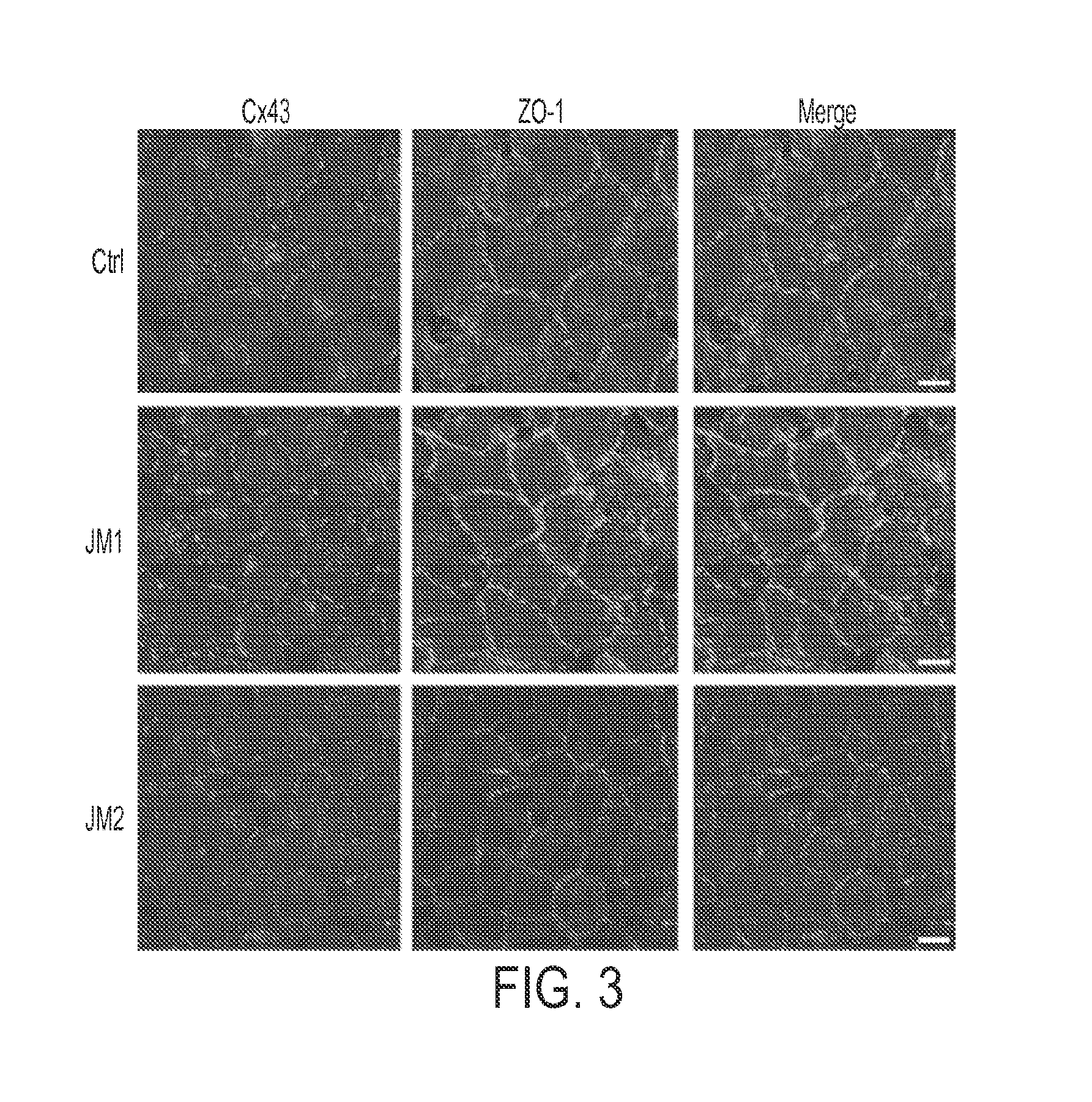 Compositions and methods for wound healing and tissue repair