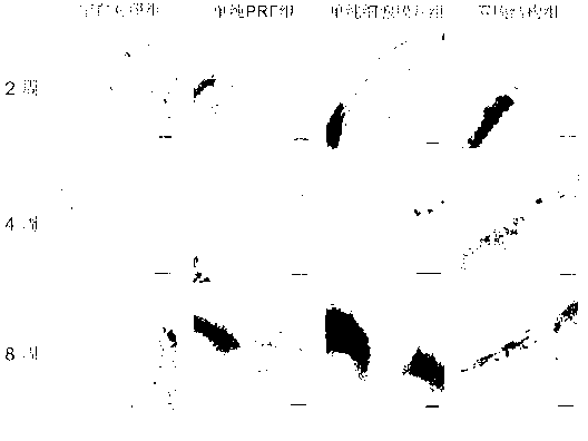 Preparation method and use of graft material in double membrane structure