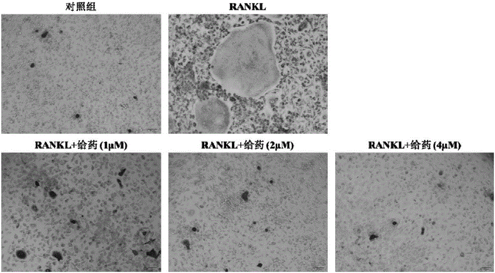 Application of group of thio-matrine derivative and salts thereof to preparation of anti-osteoporosis medicament