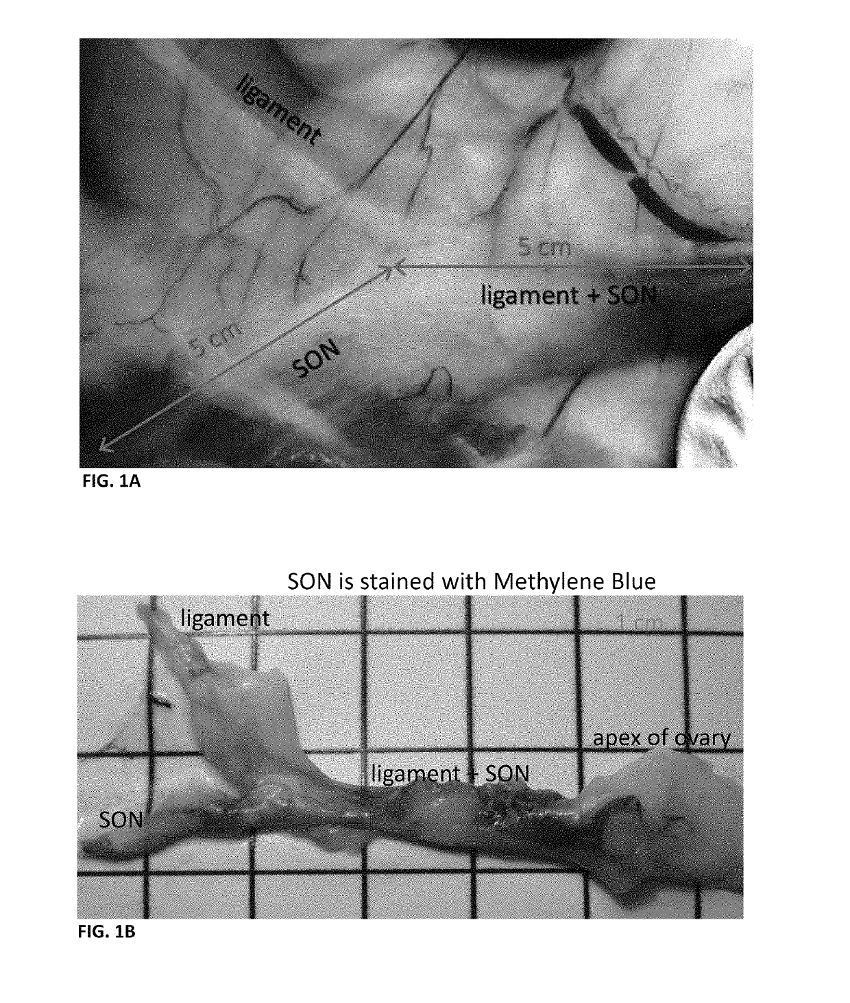 Neuromodulation device