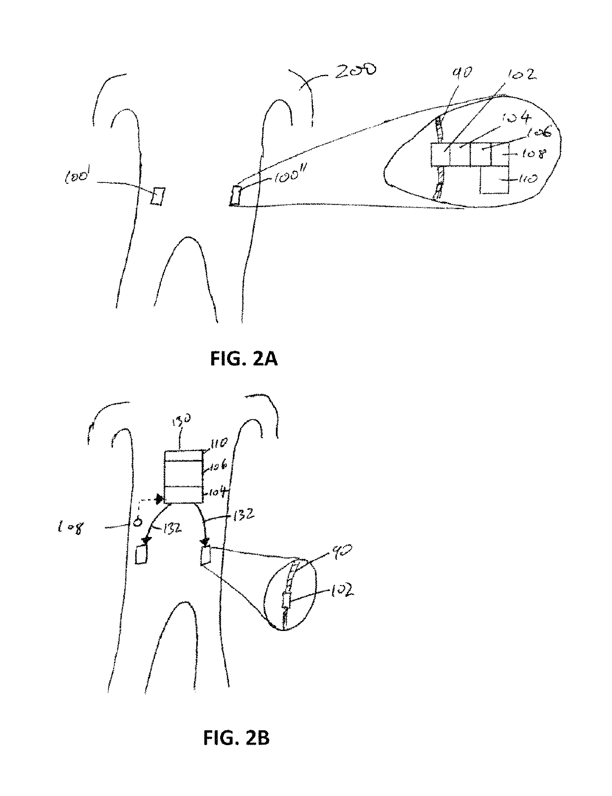 Neuromodulation device