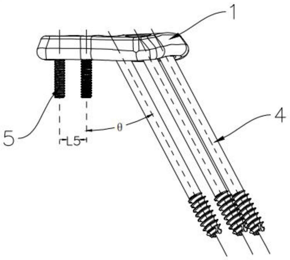 Dynamic pressurizing device for bone trauma repair