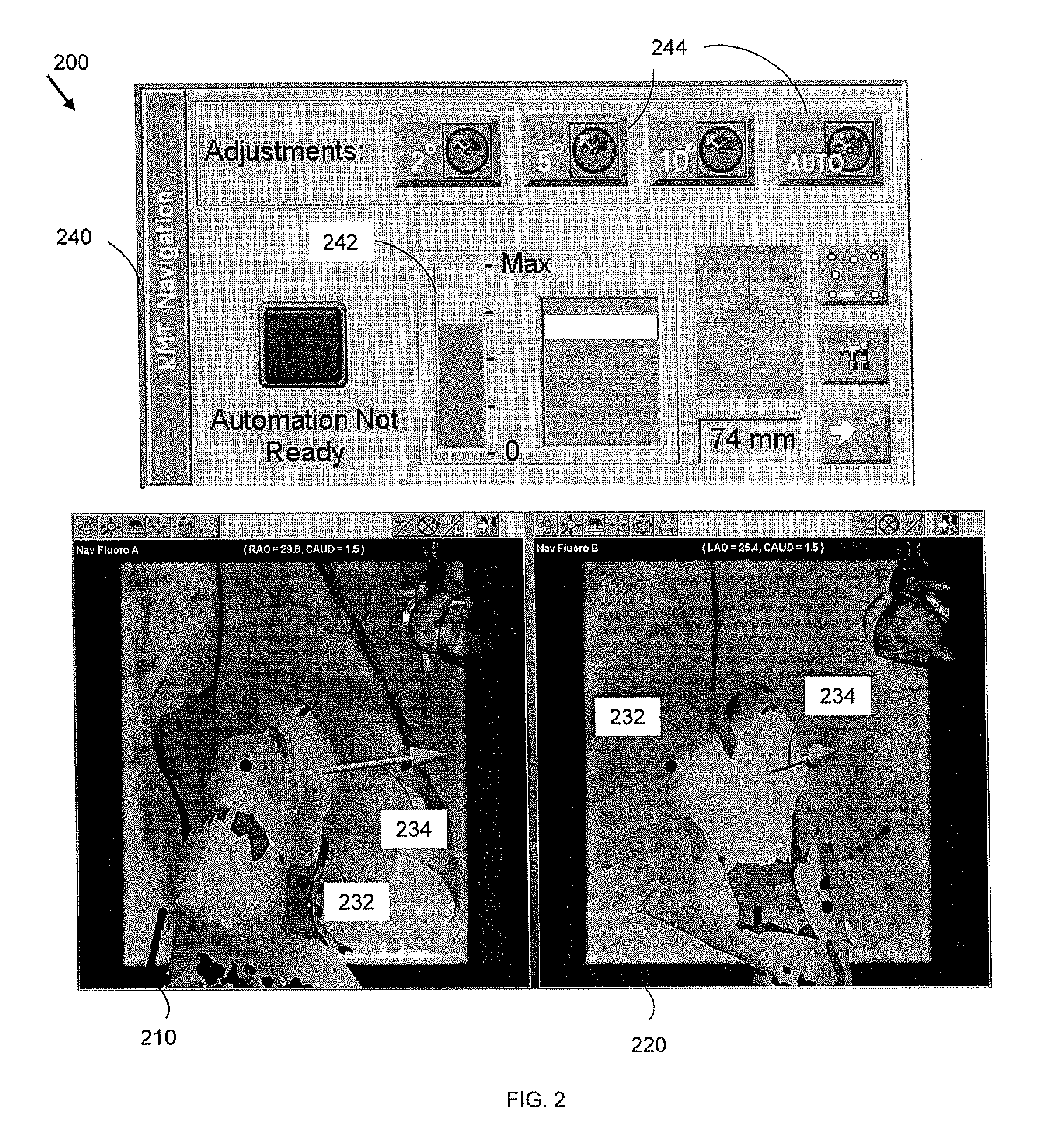 Method and apparatus for delivery and detection of transmural cardiac ablation lesions