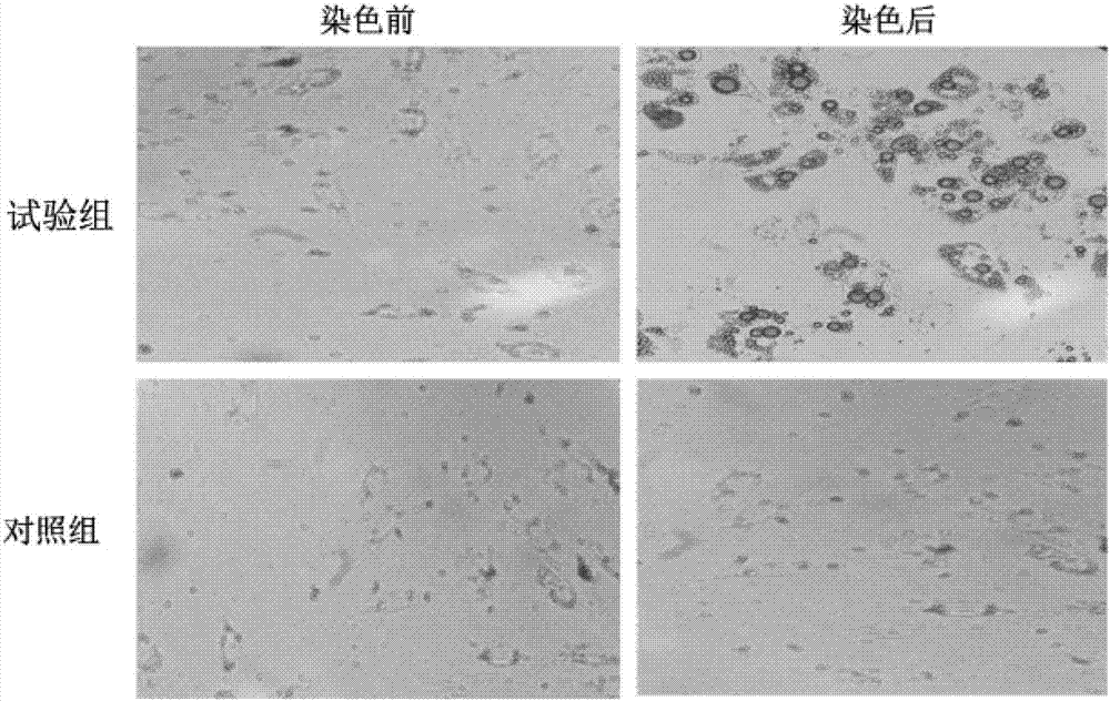 Cell frozen preservation solution and cell frozen preservation method