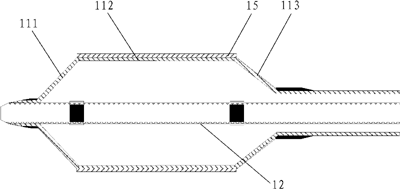 Interventional medical device