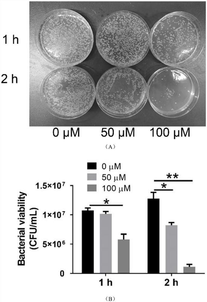 Application of nanogold in preparation of medicine for treating shigella infectious enteritis and medicine preparation of nanogold